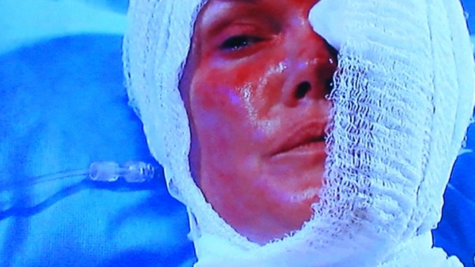 Ava Maura West is delivering Emmy worthy performances this past month on General Hospital